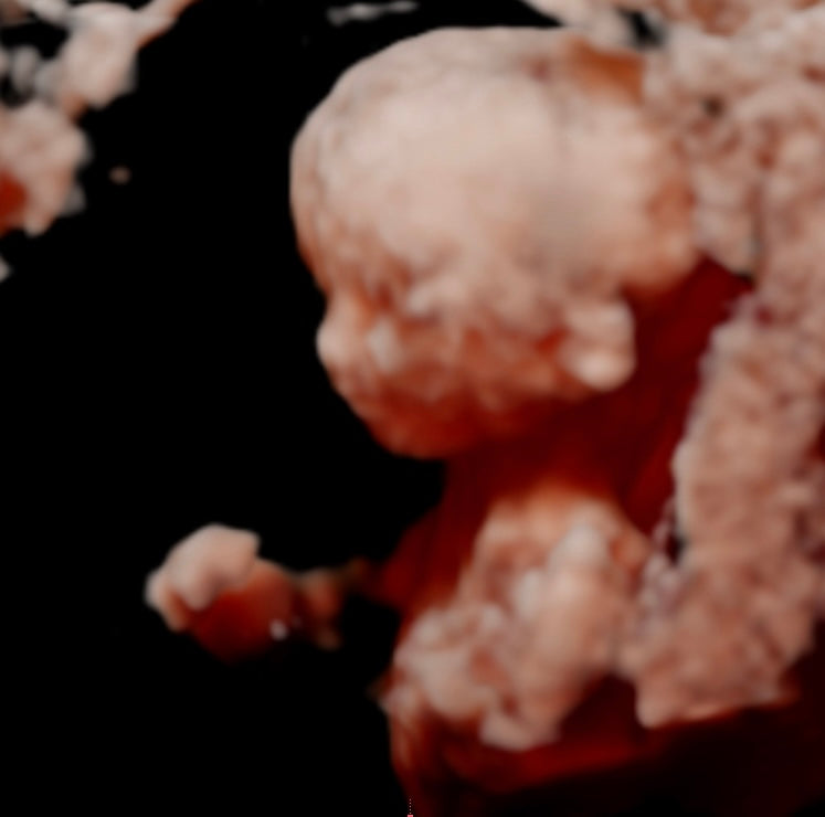 image-text image-text