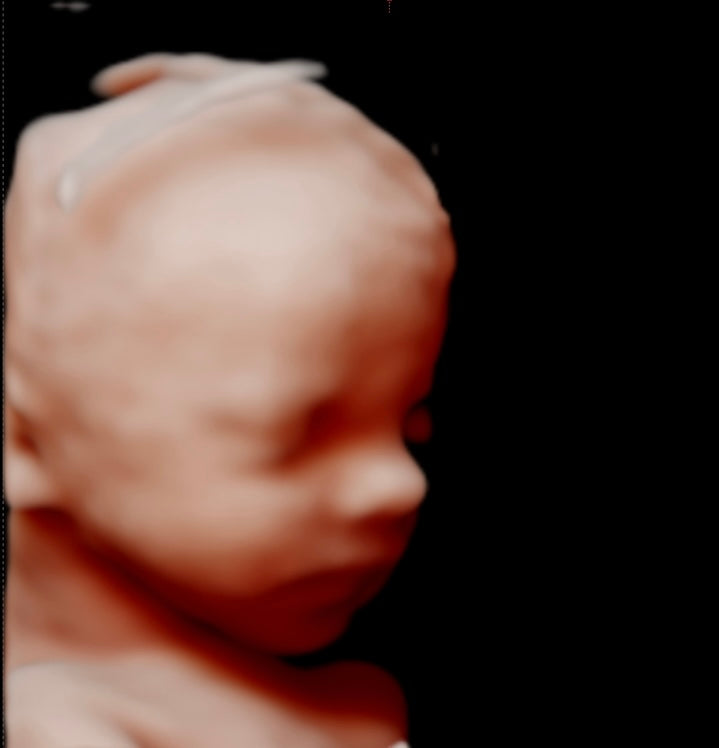 image-text image-text