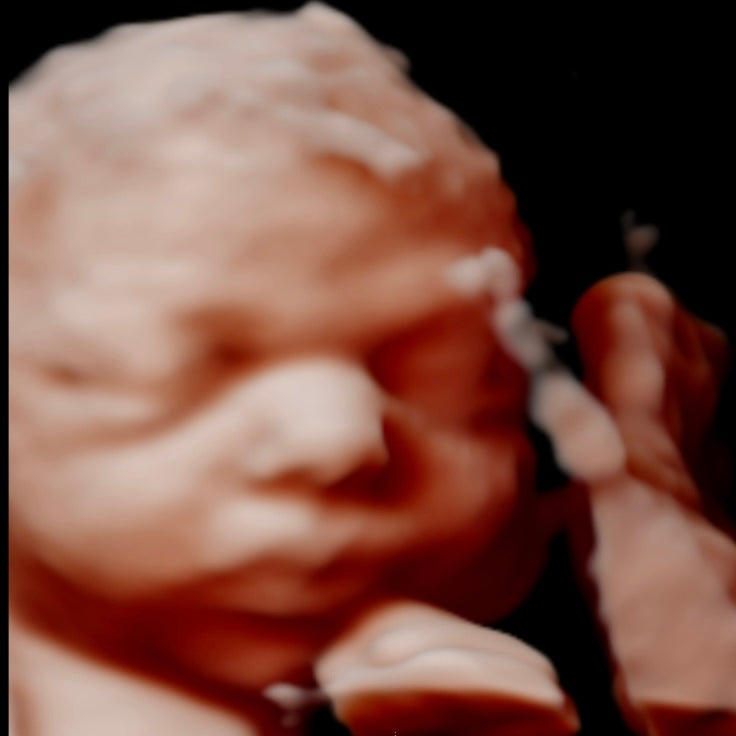 image-text image-text